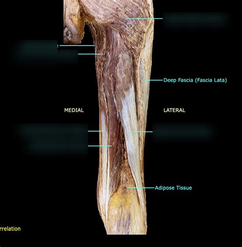 hamstring muscles labeling function Diagram | Quizlet