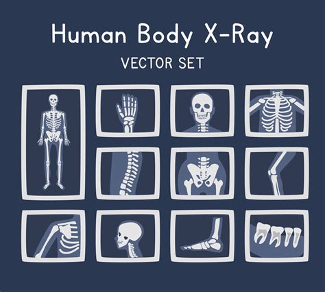 X Ray clipart cartoon style. Human body bones x ray flat vector set illustration hand drawn ...