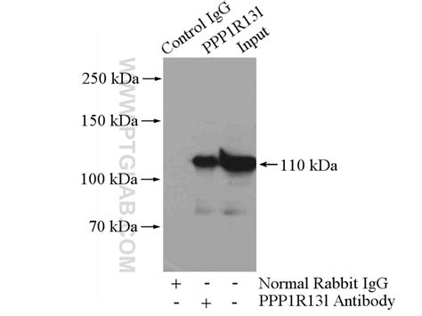 iASPP antibody (18590-1-AP) | Proteintech