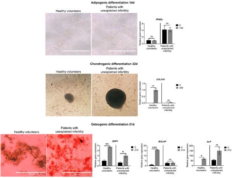 Menstrual Blood-Derived Endometrial Stem Cells’ Impact for the ...