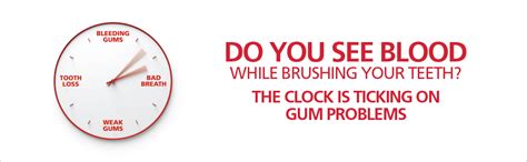 Parodontax Daily Fluoride Toothpaste For Daily Protection Against Gum ...