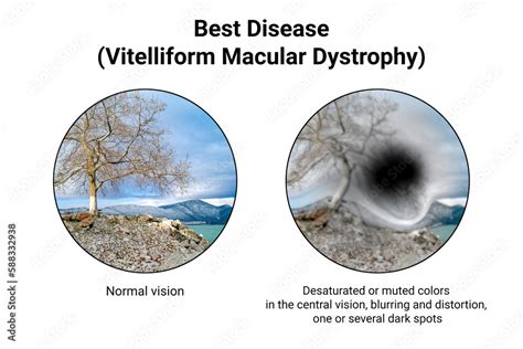 Types of Vision 的图像结果