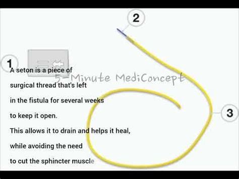 Image result for Math Problem in Matrix