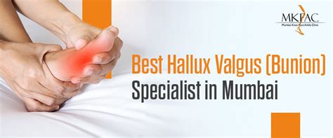 Best Hallux Valgus (Bunion) Specialist in Mumbai