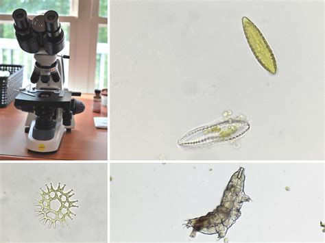 Microscope Bacteria 的图像结果