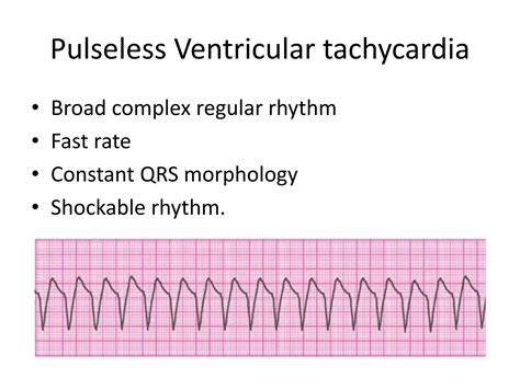 7-Cardiac_arrest(1).pptx