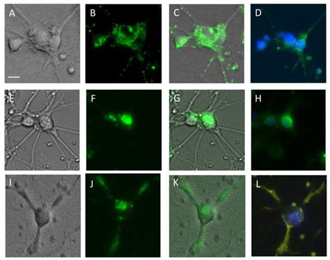 A New Method for the Visualization of Living Dopaminergic Neurons and ...