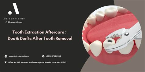 Image result for Infected Tooth Extraction Aftercare