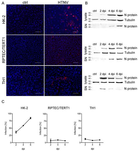 Differences in the Susceptibility of Human Tubular Epithelial Cells for ...