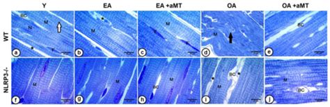 Age and Chronodisruption in Mouse Heart: Effect of the NLRP3 ...