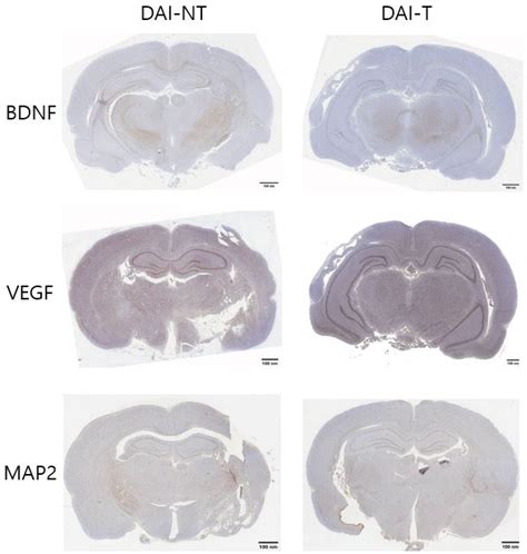 The Effect of Repetitive Transcranial Magnetic Stimulation on Cognition ...