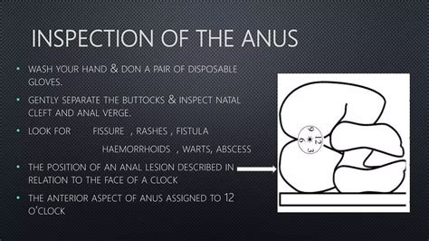 Digital rectal examination.pptx @ | PPTX