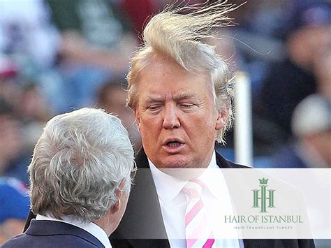 Is Trump Bald