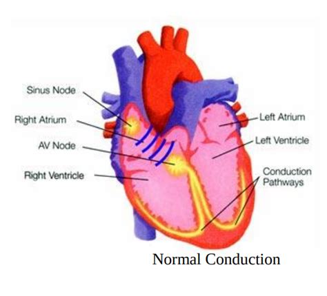 Image result for Cardioversion Steps