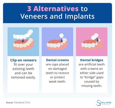 Veneers vs. Dental Implants: Which Is Right for You? | Shiny Smile Veneers