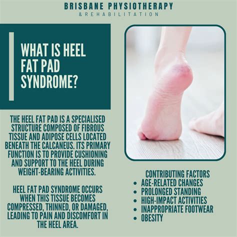 What is Heel Fat Pad Syndrome? - Brisbane Physiotherapy & Podiatry