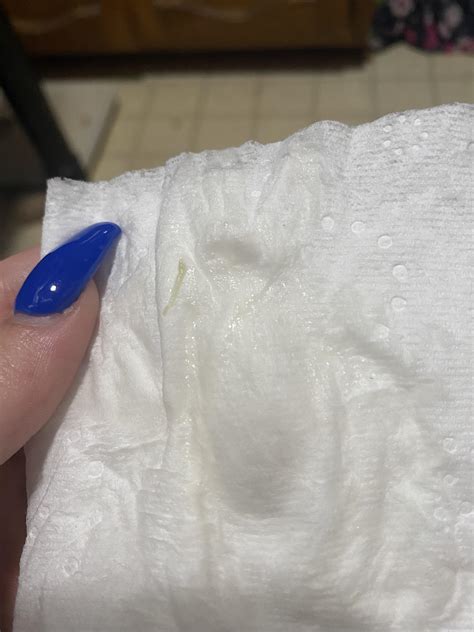 Early Pregnancy White Discharge