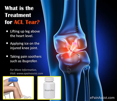 Treatment for ACL Tear|Surgery|Post Operative Rehab|Recovery