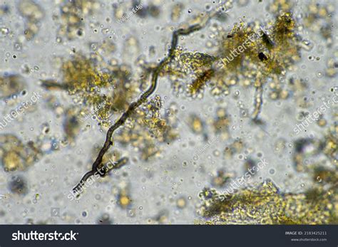 Fungal Fungi Hyphae Under Microscope Soil Stock Photo 2183425211 ...