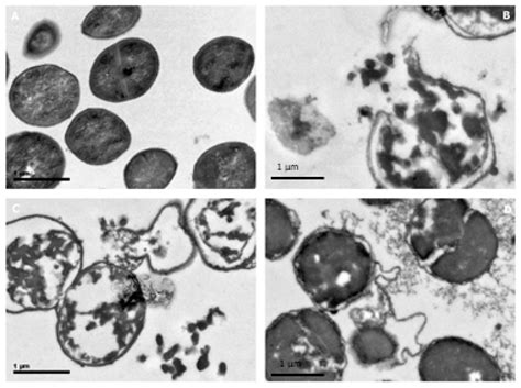 Antibacterial Activity of Hen Egg White Lysozyme Denatured by Thermal ...