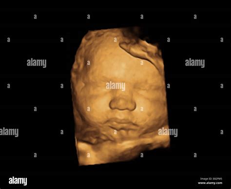 36 Weeks Pregnant Ultrasound