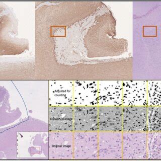 Image result for Transect Method
