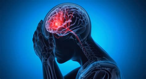 Understanding Stroke Symptoms - Covenant Health