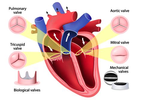 Holy heart Hospital in Rohtak, Top Cardiologist in Haryana, India
