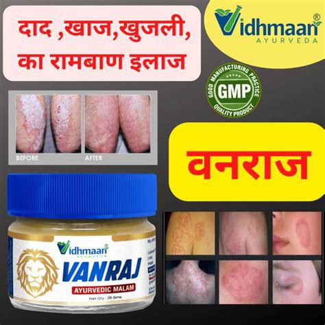 Fungal Infection Cream - Buy Fungal Infection Cream online at Best ...