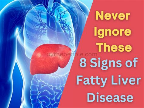 Fatty liver disease: stages, symptoms, causes, treatment in hindi