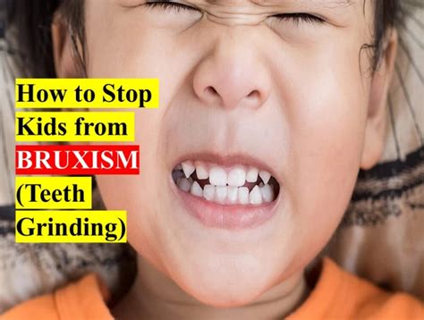How to Stop Kids from Bruxism (Teeth Grinding)|SDCINDIA
