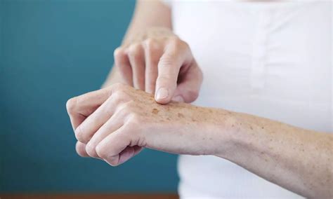 Groundbreaking study shows novel peel combination as safe and effective ...