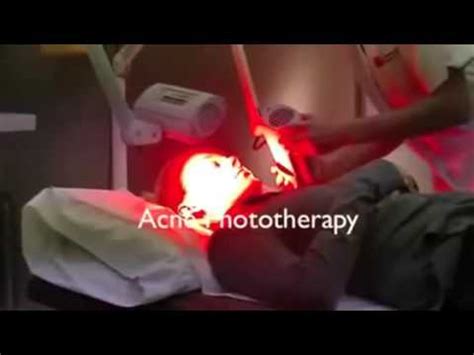 Image result for Exploding Zits 2019