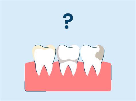 7 Types of Teeth Stains (And How to Remove Them)