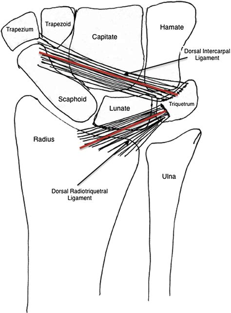 Scapholunate Ligament Tears - Orthopedic Clinics