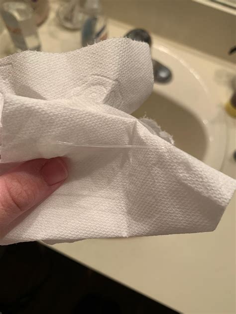 when did you ovulate post partum? TMI PHOTO | BabyCenter