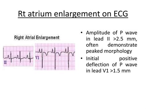Right ATRIUM.pptx
