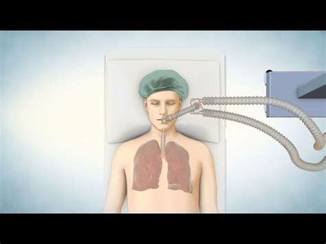 Exploring the Role of Stem Cells in Lung Transplantation | ArogyaJivan