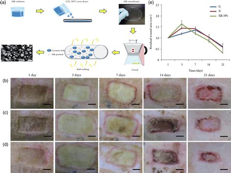 Types Of Wound Drainage
