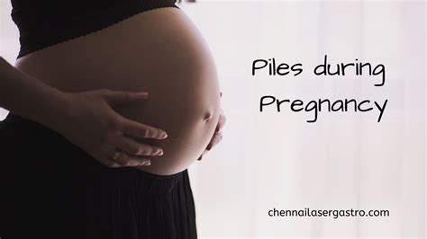 pregnancy Hemorrhoids Archives - Laser Gastroenterology Clinic