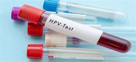 Global Hpv Testing & Pap Testing Market 2019- Industry Outlook ...