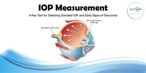 Gallery | Optical & Ophthalmic Solutions Singapore | Vitop