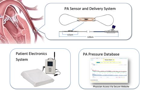 Image result for Frequency Matching Biomedical Device