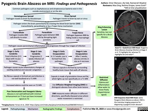 Pyogenic Brain Abscess on MRI: Findings and Pathogenesis | Calgary GuideCalgary Guide