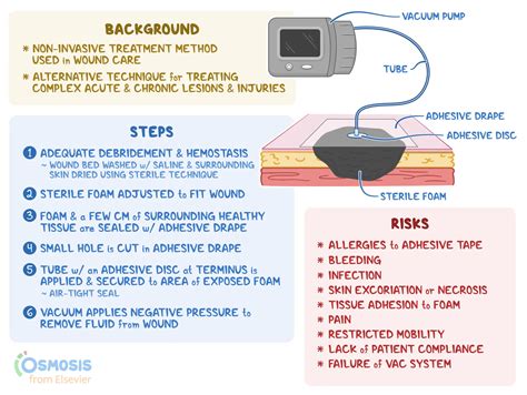Wound Vacuum-assisted Closure (VAC) Therapy: What Is It, How It Works | Osmosis