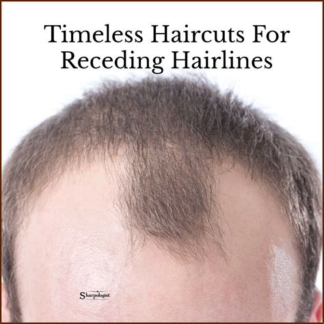 Short Haircuts For Men With Receding Hairline