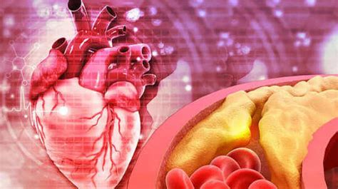 5 warning signs of high LDL cholesterol you may notice while walking