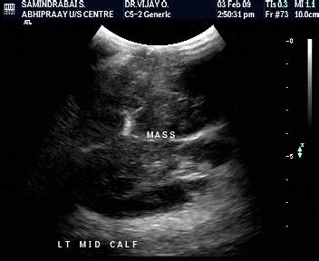 Know the Basics Of Musculoskeletal Ultrasound