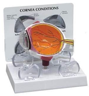 Corneal Conditions Eye Model buy in Mumbai