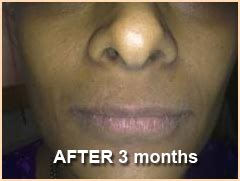 Derma Vision - Centre for Skin, Hair, Nail & Cosmetic Care